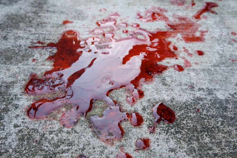 Vomito con sangre